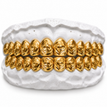 Rose Cut Gold Grill